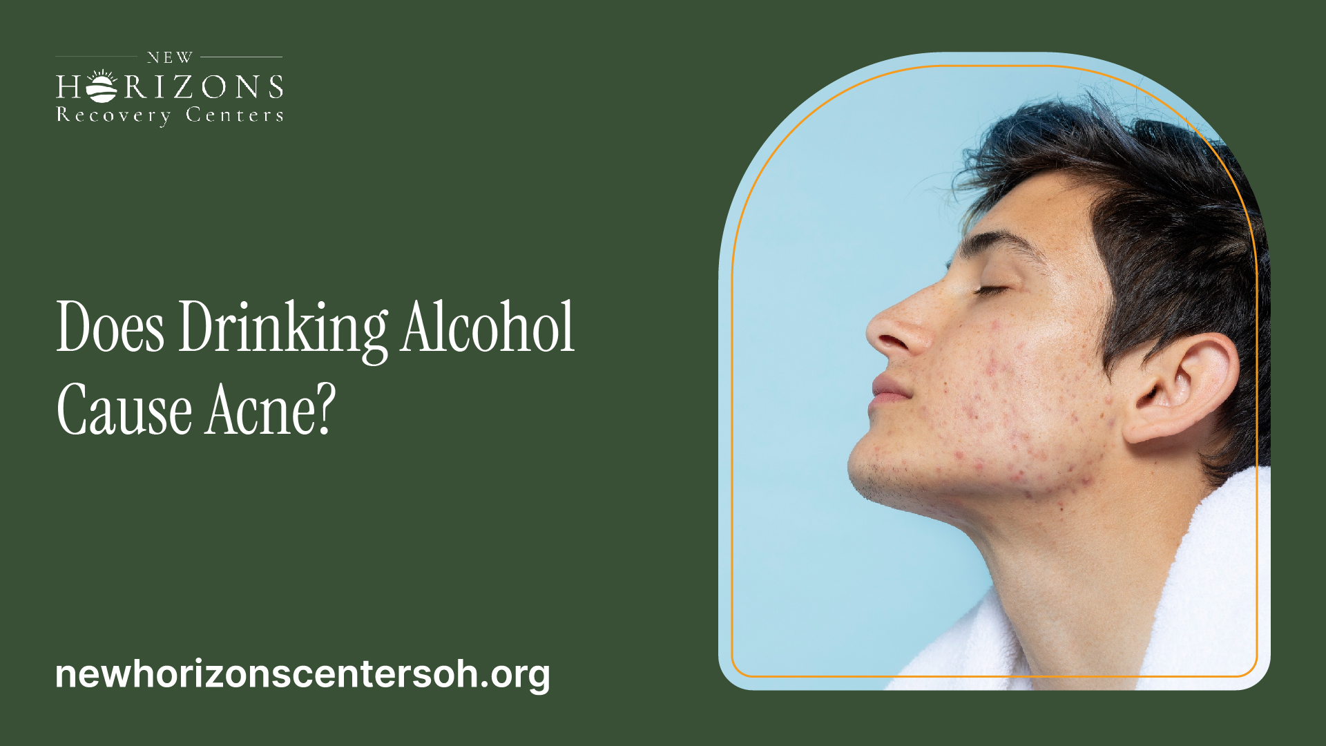 Does Drinking Alcohol Cause Acne?